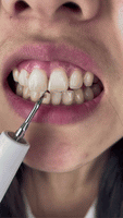 SmileSonic Pro